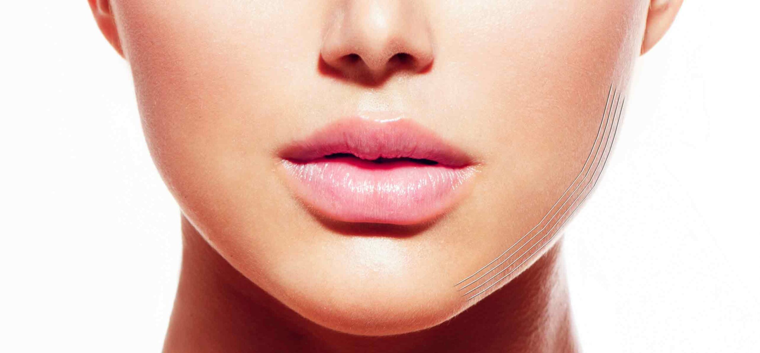 Jawlines