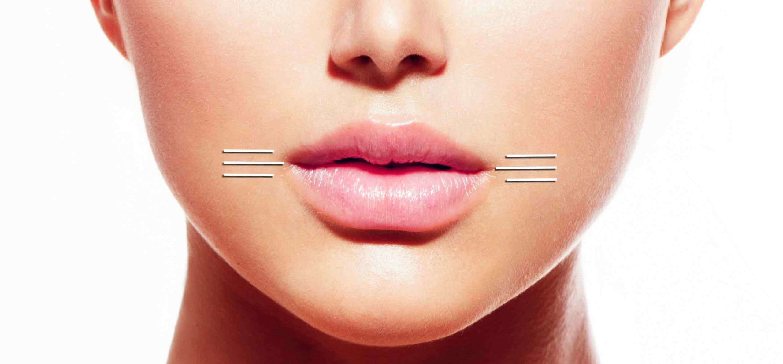 Lips Corner
