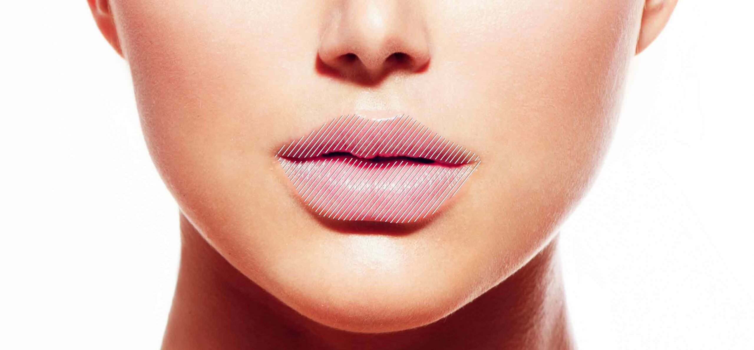 Hyamax Deamal filler