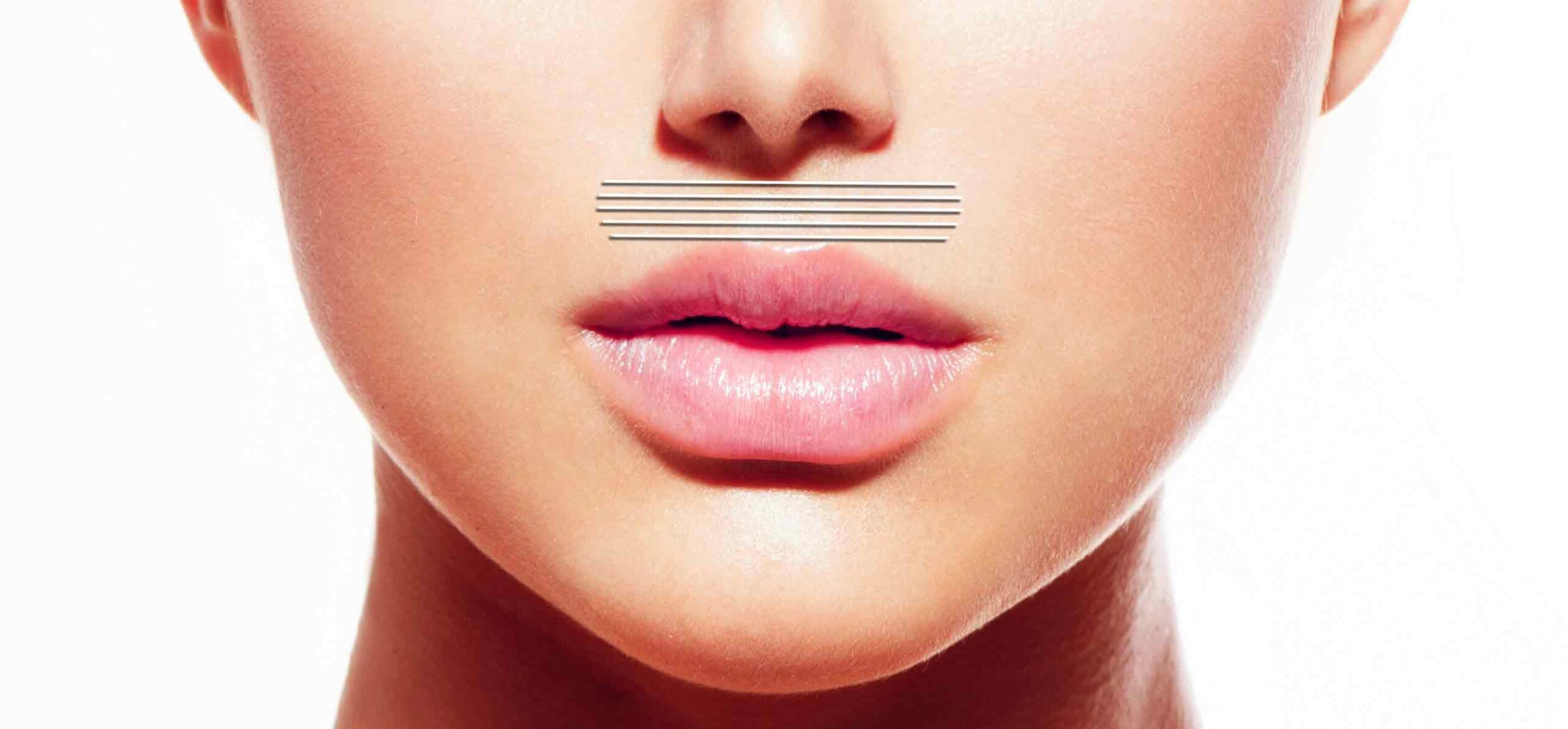 Upper Lips
