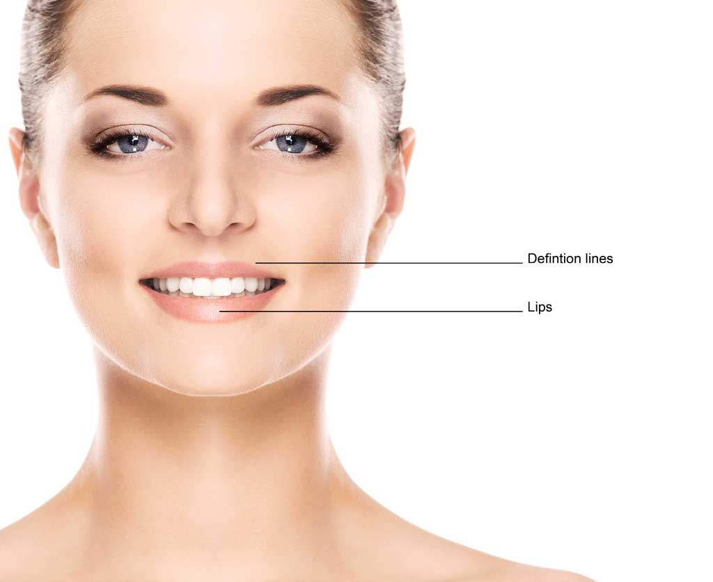 Hyamax Lips Treatment Areas